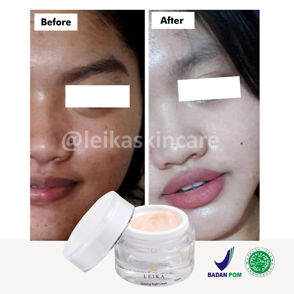 Ampuh! Krim untuk Mengurangi Minyak di Kulit Wajah Cream Menghilangkan Muka Berminyak Krim Muka untuk Kulit Berminyak Ampuh Penghilang Wajah Berminyak Glowing Night Cream Leika Skincare 10gr Resmi BPOM dan Halal