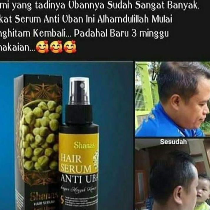 Readystock JVK Obat uban dan rambut - Obat uban pria - Obat uban rambut permanen - Obat uban paling