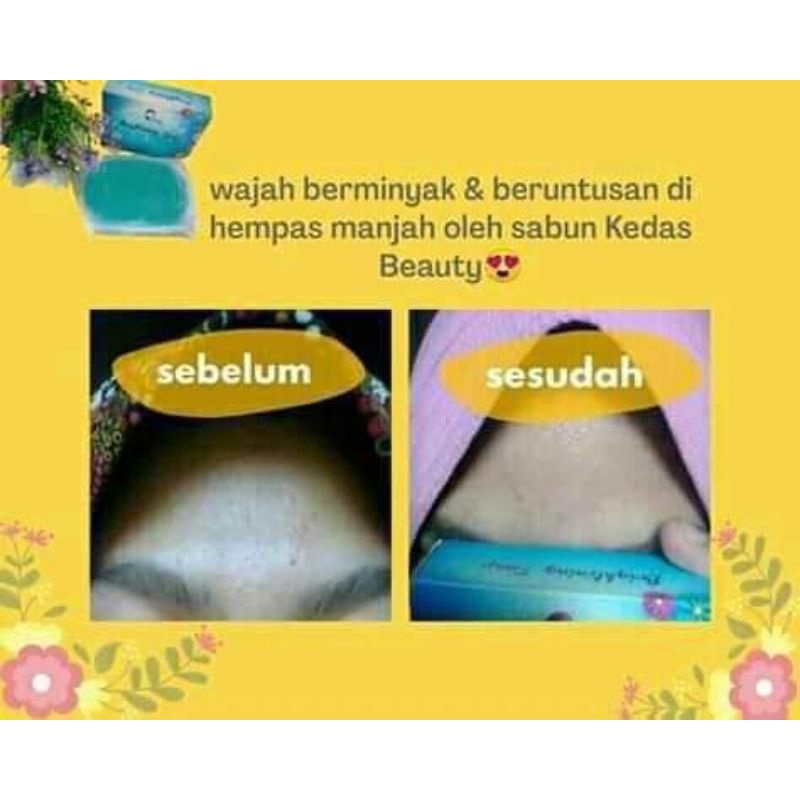 [ORIGINAL] KEDAS BEAUTY BRIGHTENING SOAP, SABUN PEMUTIH WAJAH, SABUN PENCERAH WAJAH, 100g-3