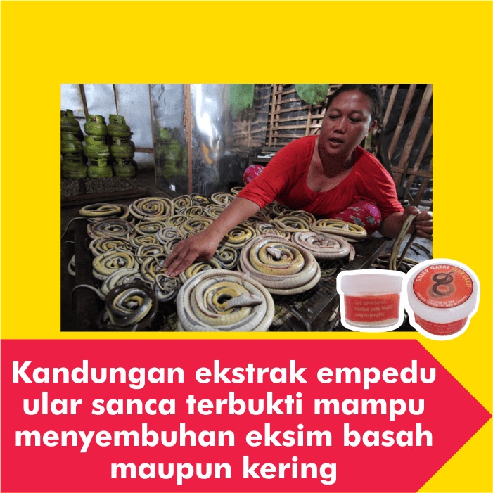 Salep Obat Gatal Eksim Kering Menahun Paling Ampuh Kulit Gatel Exim Basah Saleb Selangkangan Kurap Kutu Air Luka Diabetes Panu Kudis Kadas-6