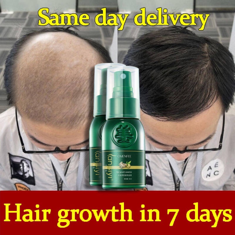 pertumbuhan rambut Hair Growth Essence Esensi Semprotan jahe 30ml Hair Treatment Shampoo Botak Rontok germinal rambut Perawatan Hair Care Efektif Menumbuhkan Rambut