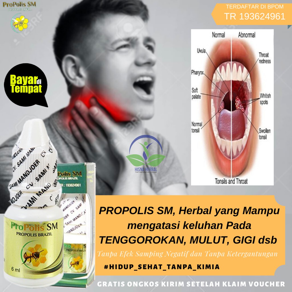 Obat Amandel Radang Infeksi Amandel Sakit Tenggorokan Nyeri Menelan Anak Dewasa Propolis Shopee Indonesia