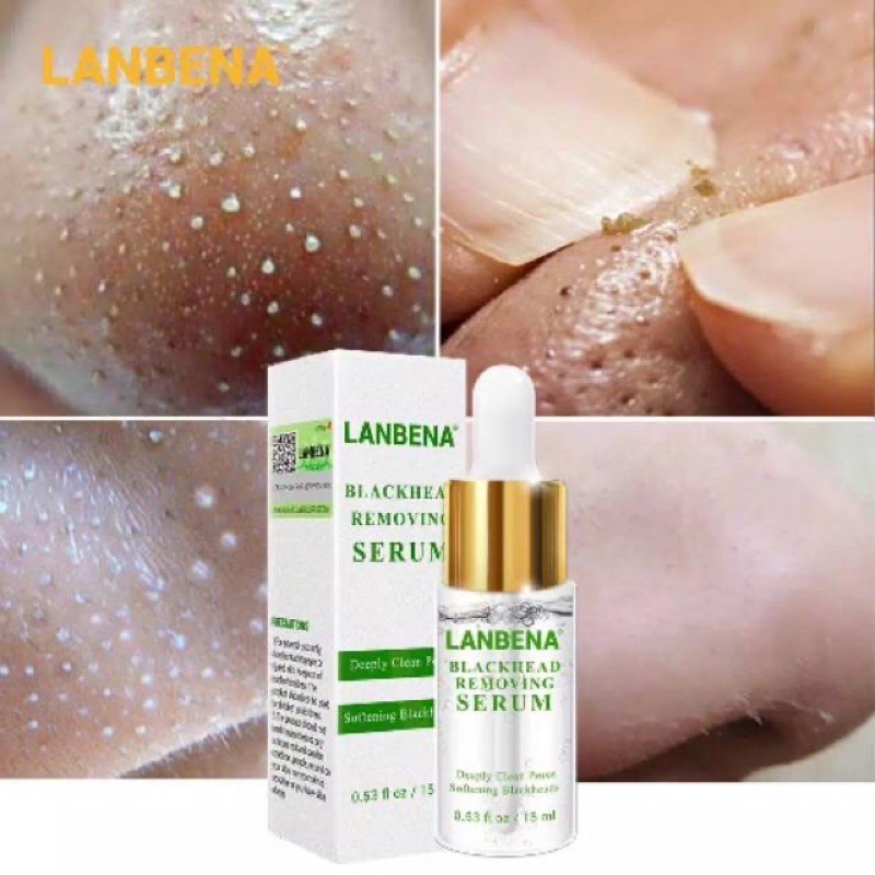 labena removing blackheads