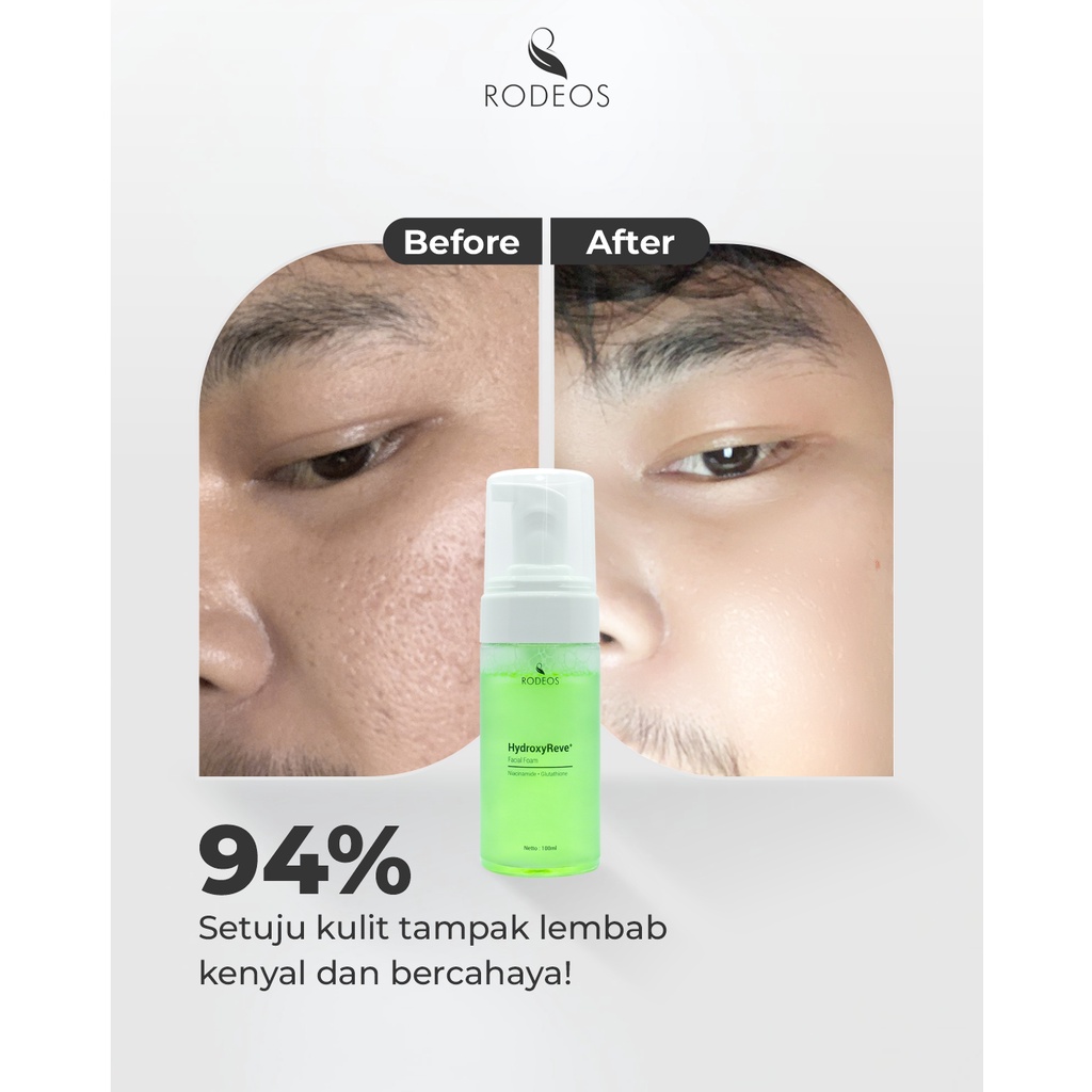 Rodeos HydroxyReve Facial Foam 100ml - Sabun Muka Glowing untuk Kulit Kusam Bebas Komedo &amp; Jerawat