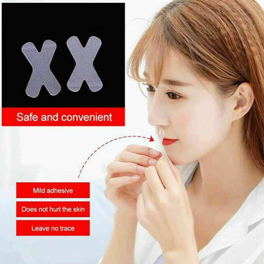 Preva 30Pcs Snore Blocker Stopper Panas Buka Mulut Pernapasan Tidur Strip X Tipe Malam Digunakan Bantuan Tidur