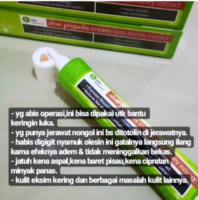 Aloe propolis cream untuk bekas jerawat