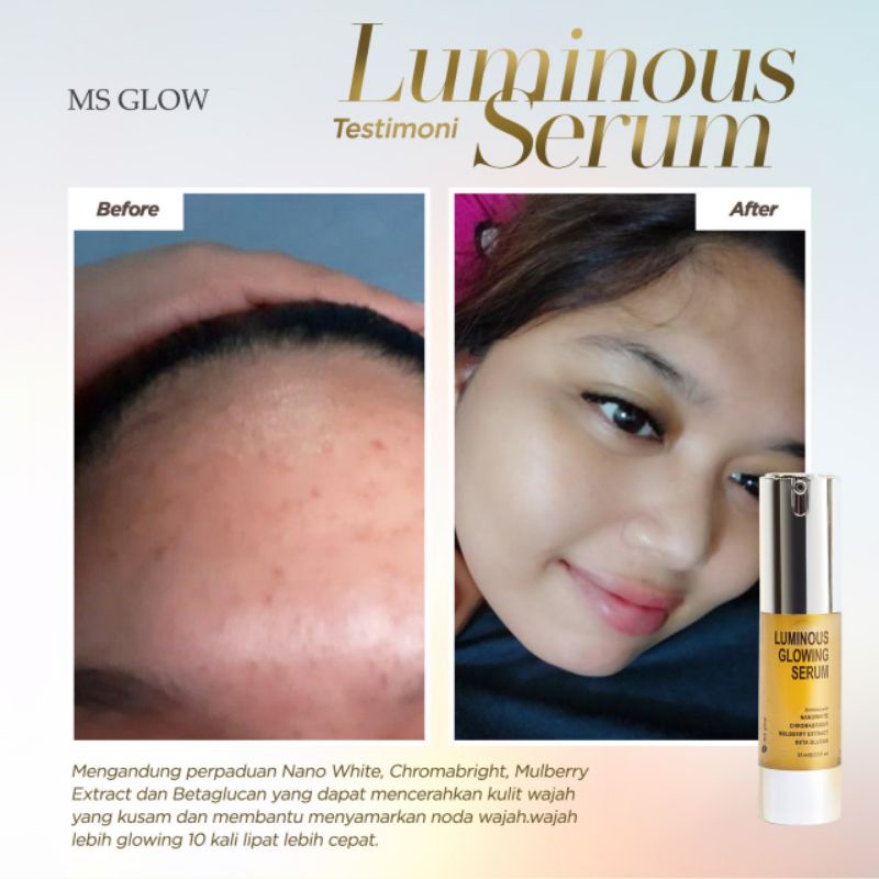 Ms Glow Luminous Glowing Serum Ms Glow Original 100% Serum Luminous Pencerah 10x Lipat Penyamar Noda Bekas Jerawat Dan Flek Tipis