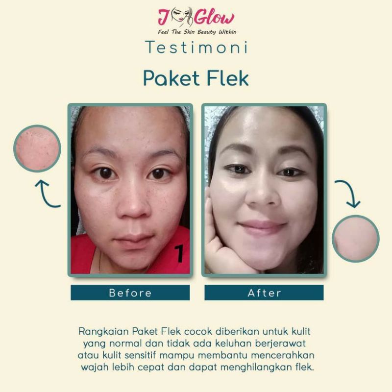 Jglow Skincare Paket Flek Peeling Serum Whitening Cream Skin glowing Perawatan Wajah Kecantikan Bpom-7