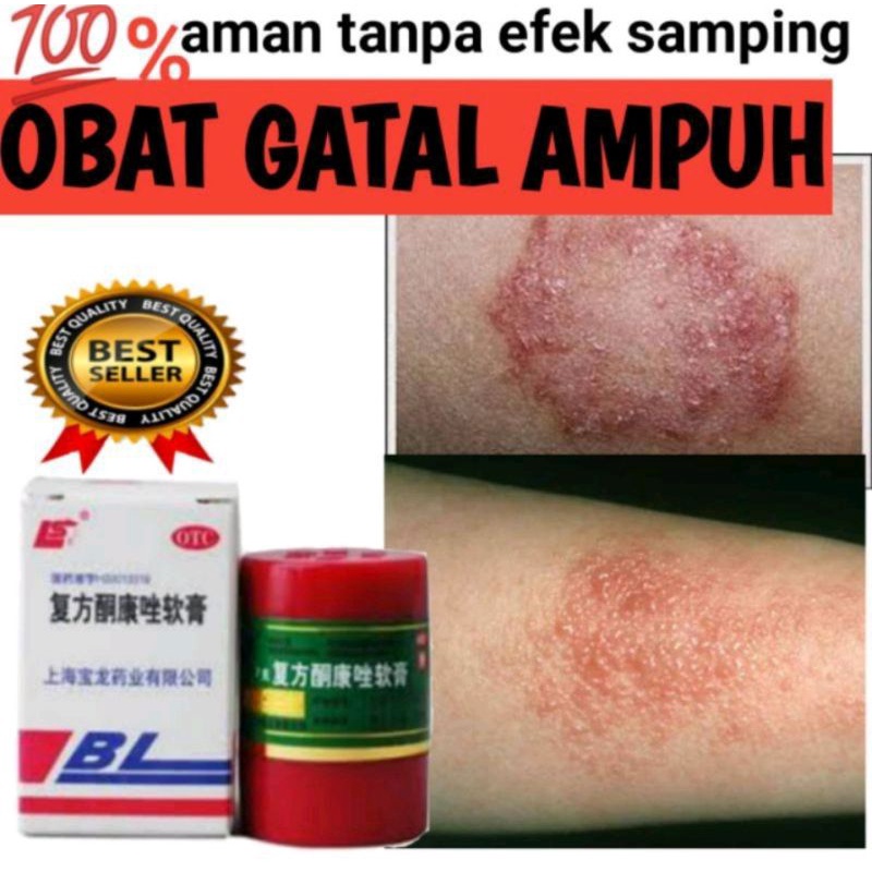 CREAM BL/SALEP GATAL