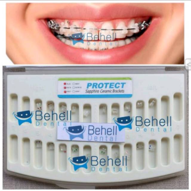 Paket Behel  Permanen Bracket Clear Ceramic Protect 0 18 0 