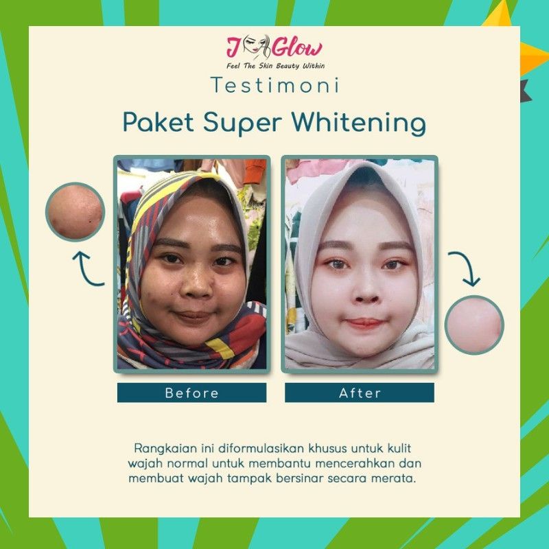 jglow skincare paket super whitening / j-glow paket super whitening / j glow paket super whitening