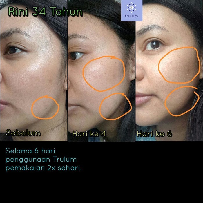 Trulum Review : Trulum Skincare Review Banten Info 08128441055 - Hours, address, all about tulum reviews: