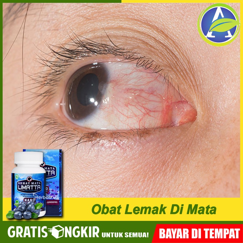 Obat Lemak Mata, Obat Mata Berlemak, Lemak di Mata LIMATTA Sehat Mata Original
