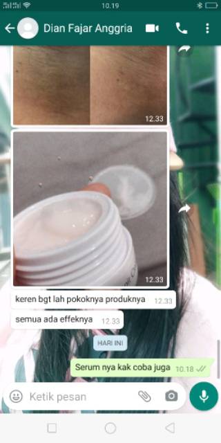 CHROMABRIGHT ARMPIT CREAM / CREAM PEMUTIH KETIAK, LIPATAN TUBUH LAINNYA