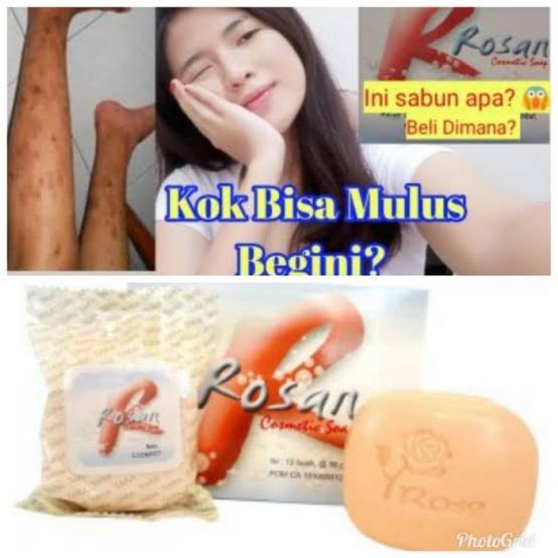 Sabun Rosan Beauty Kesehatan Kecantikan Glowing Anti Jerawat Alergi Aroma Mawar