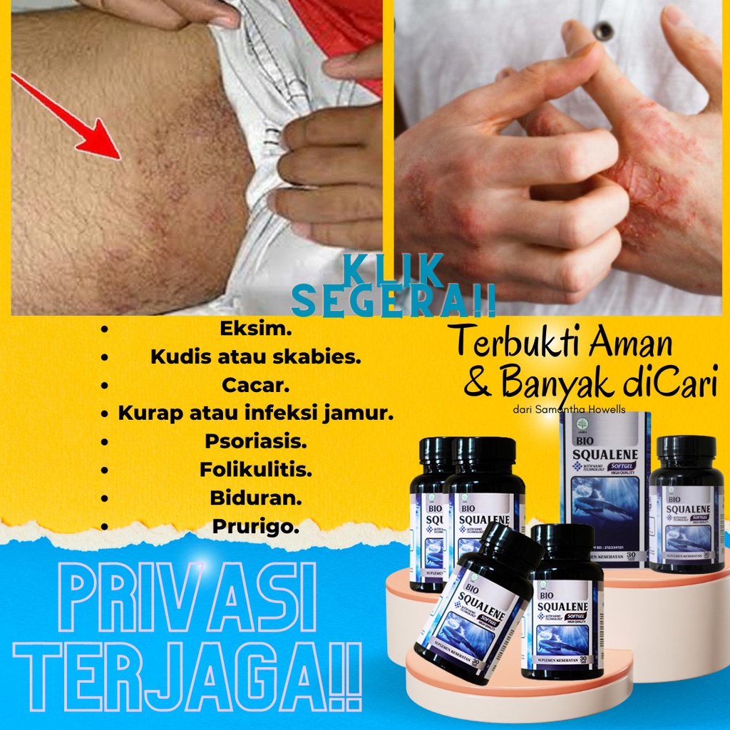 Obat Gatal Kulit, Gatal di Tangan, Gatal di Kaki, Gatal Selangkangan Eksim dan Jamur Paling Banyak d