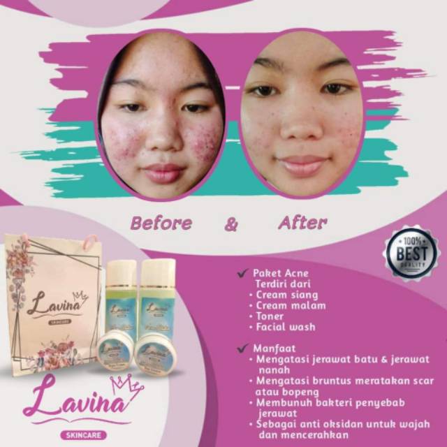 cream lavina skincare bpom