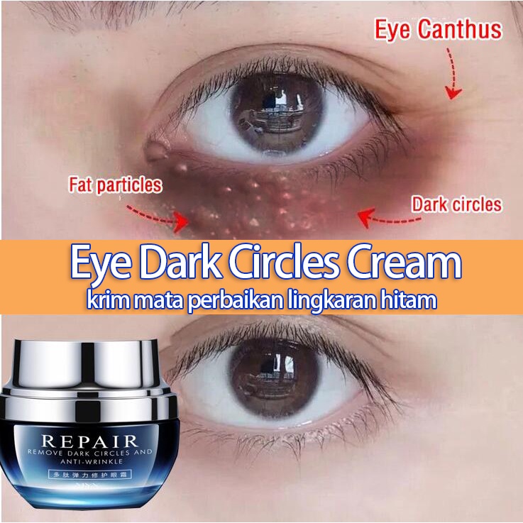 Eye cream Krim mata Dark circle eye cream Krim mata lingkaran hitam Krim mata anti penuaan 30g perawatan mata Menyehatkan area mata Meringankan lingkaran hitam Meringankan kantung mata dan butiran lemak