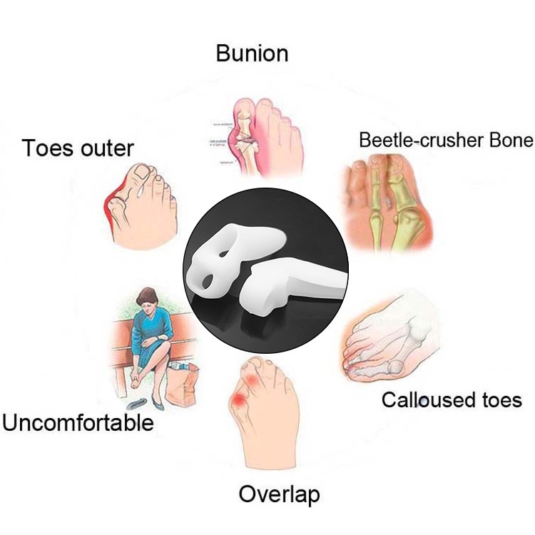 1 Pasang Silicone Gel Thumb Corrector Bunion Pelindung Kaki Kecil Pemisah Hallux Valgus