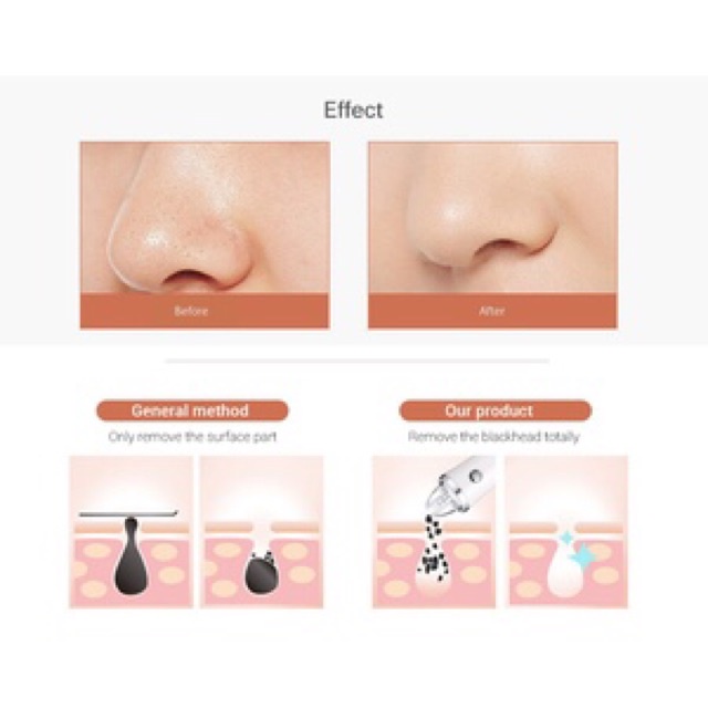 Kemei KM - 1871 7 in 1 Blackhead Vacuum Cleaner Beauty Suction Acne Removal