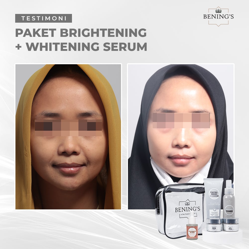 Paket Skincare Brightening Bening Skincare Dr Oky Pratama Pencerah Pembersih Pemutih Wajah Perawatan Kecantikan Termurah Premium