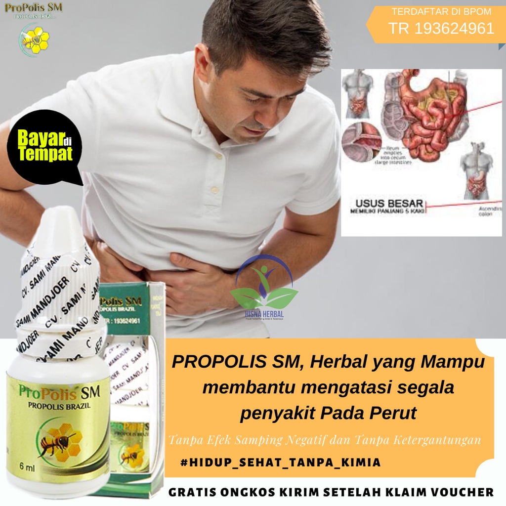 Propolis SM (100% Herbal Alami) Mengobati Infeksi Luka Pada Lambung Alami ORIGINAL, Obat Mag China I