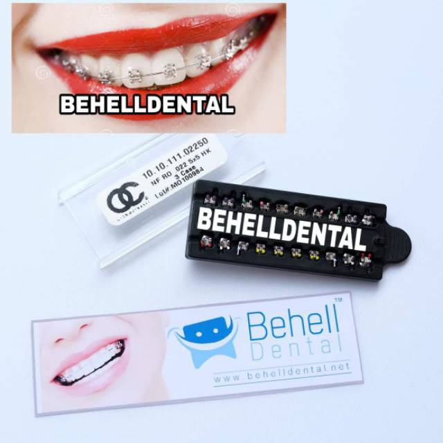 PAKET BEHEL PERMANEN METAL ORTHO BRACKET ORTHO CLASSIC USA ROTH WITH HOOK - Braces Dental OC OrthoClassic Untuk Perbaikan / Perawatan Gigi - Kawat Orthodontic Metalic - Behelldental Mim