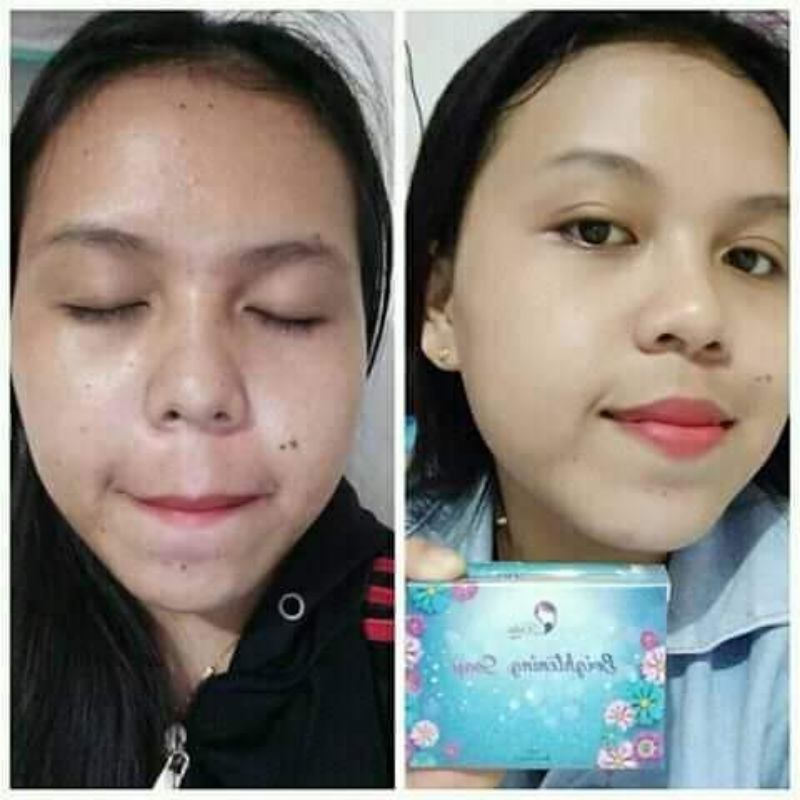 [ORIGINAL] KEDAS BEAUTY BRIGHTENING SOAP, SABUN PEMUTIH WAJAH, SABUN PENCERAH WAJAH, 100g-2