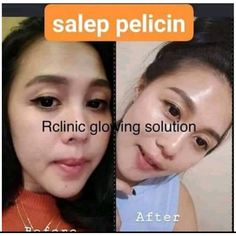 SALEP PELICIN RCLINIC DOKTER/SALEP PELICIN NIGHT/SALEP BOOSTER