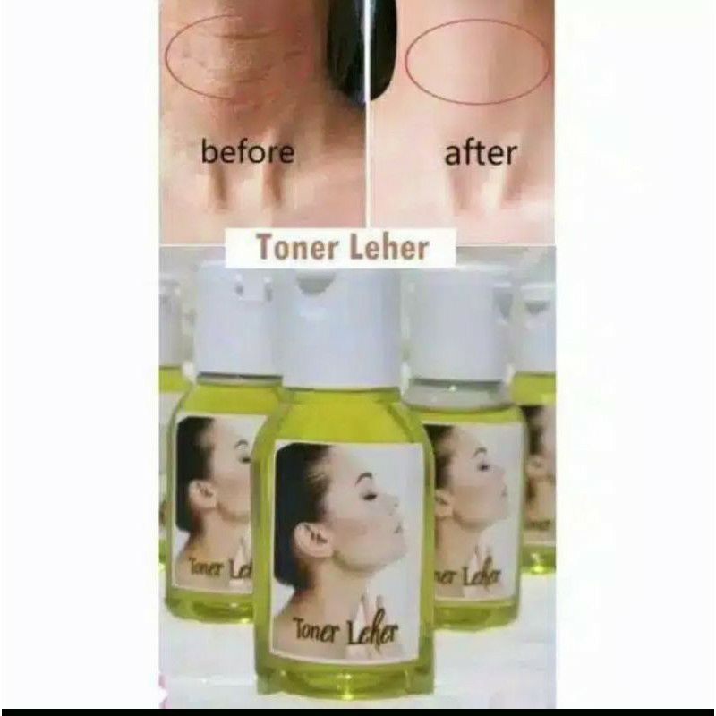 Toner Pemutih Leher