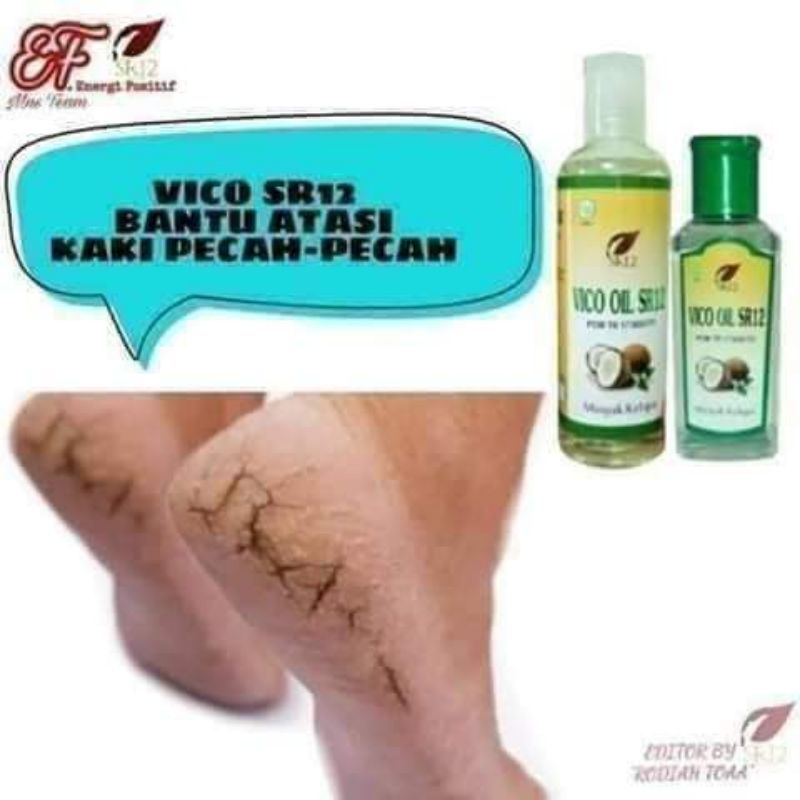 Obat Kaki Pecah dan Kering - Penghalus Tumit Kaki - Minyak Kaki Pecah2 Ampuh