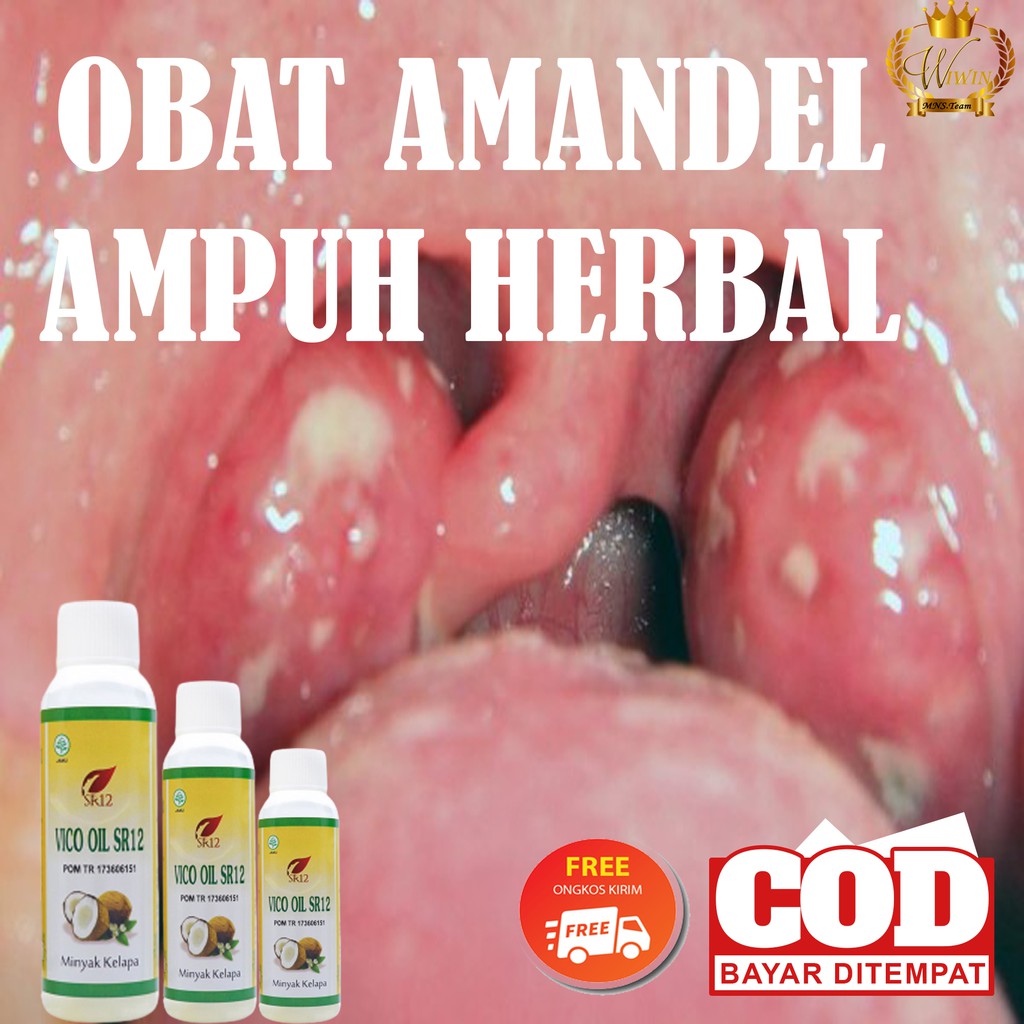 

AMPUH ATASI AMANDEL|VCO SR12/MINYAK KELAPA MURNI/OBAT AMANDEL ANAK DAN DEWASA AMAN 100% BPOM