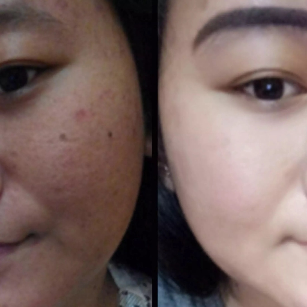 SHINE STAR - Sabun QM Brightening Glowing Whitening BPOM - Sabun Pemutih Badan Wajah dan Menghilangkan Komedo