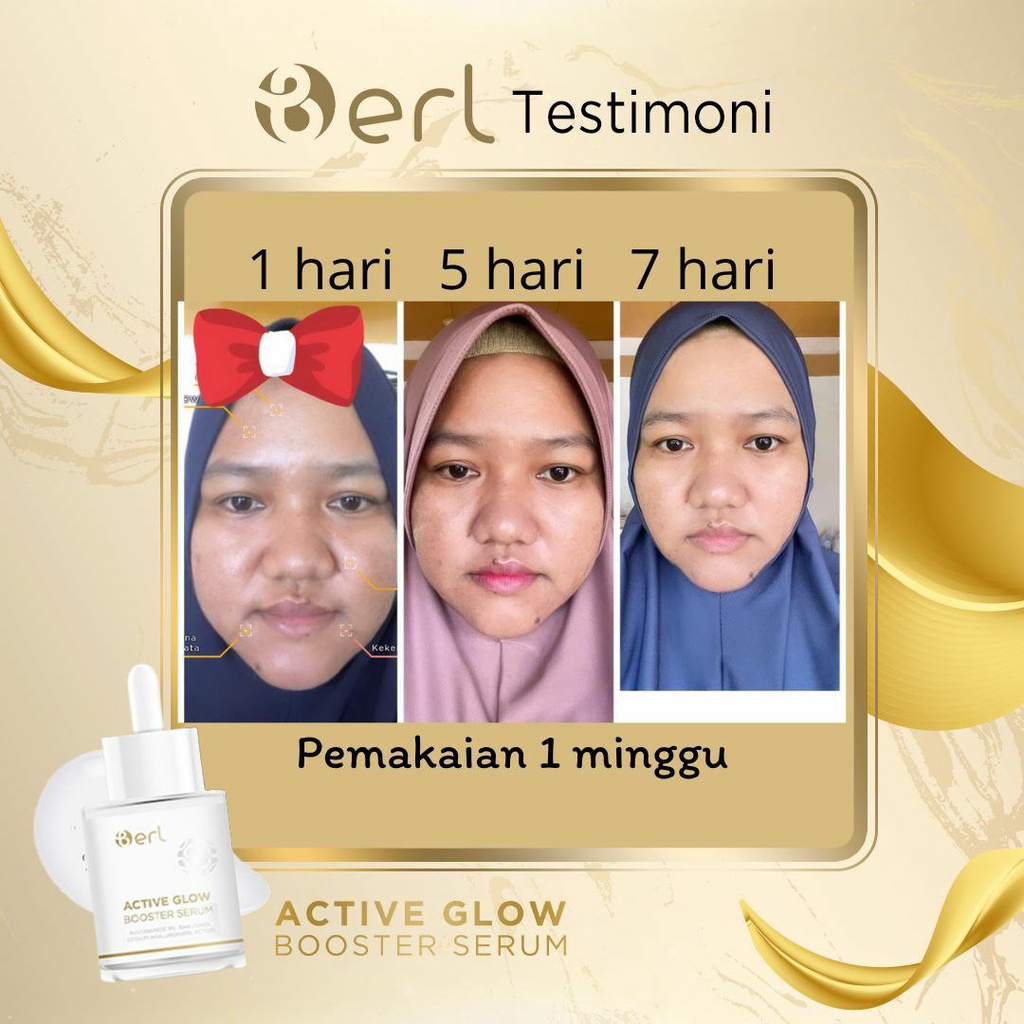 B ERL Active Glow Booster Serum | B ERL Cosmetics Pre Serum | Memperkuat Skin Barrier | Mencerahkan &amp; Melembabkan Kulit