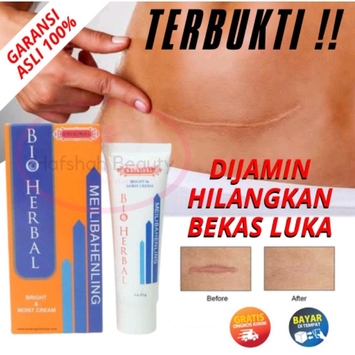 [BISA COD] Meilibahenling Original 100% Salep Cream Obat Penghilang Bekas Luka Hitam Koreng lama keloid Ampuh