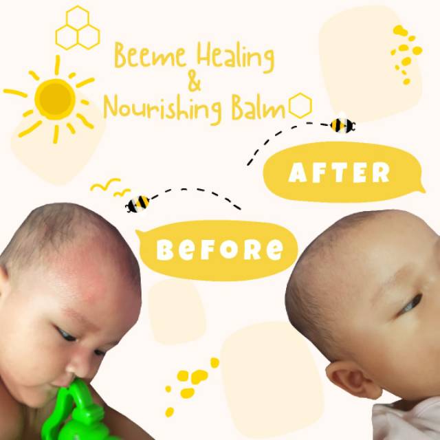 Beeme Nourishing Balm 2pcs | SKINCARE IBU DAN ANAK