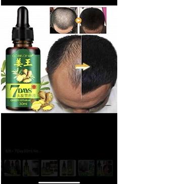 ♠ Penumbuh Rambut Botak Asli / Anti Botak / Rambut Rontok ✸