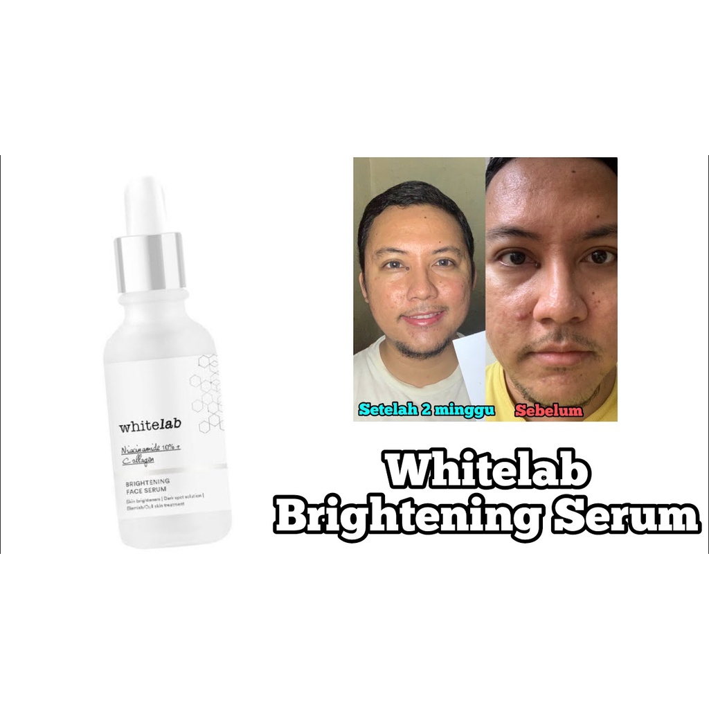 [ORI] Whitelab Brightening Face Serum AMPUH Mencerahkan Melembabkan Menyamarkan Noda Hitam BPOM 20ML