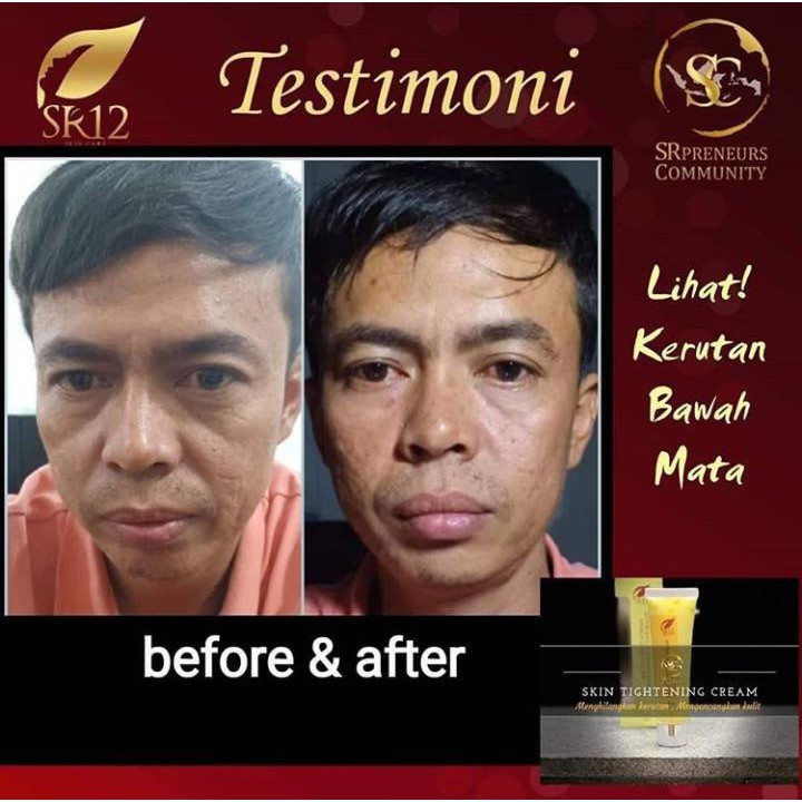 ANTI KERUT WAJAH / PEMUTIH &amp; PENCERAH WAJAH / HERBAL TIGHTENING CREAM / PENGENCANG KULIT WAJAH HALUS