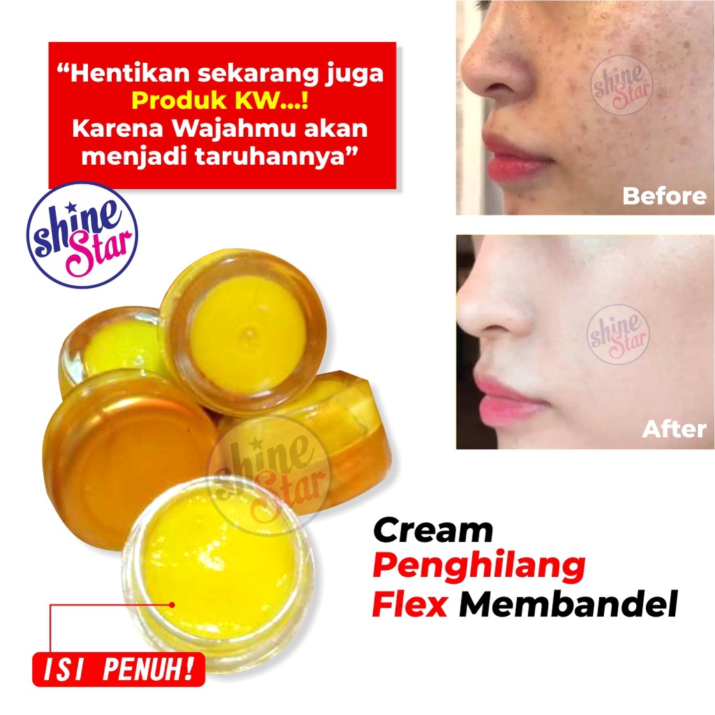 SHINE STAR - Salep Flek Hitam Membandel - SalepFlek Melasma Untuk Menghilangkan Flex Hitam / Salep Flex Hitam