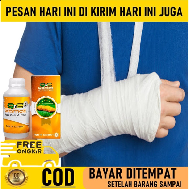Obat Tulang Retak - Obat Patah Tulang tangan - Obat Patah Tulang herbal - Obat patah tulang Gamat - 