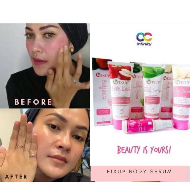 Body serum whitening | pemutih kulit tubuh FIXUP BODY SERUM | serum Vitamin C