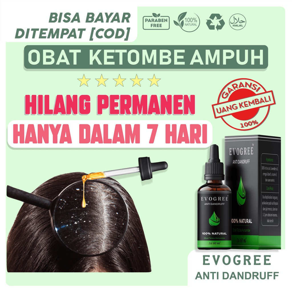 OBAT KETOMBE PARAH 100% BAHAN ALAMI JAMINAN UANG KEMBALI | EVOGREE ANTIDANDRUFF