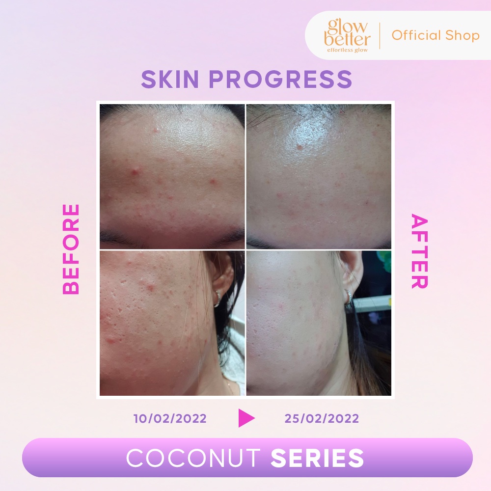 Glow Better Coconut Series-3