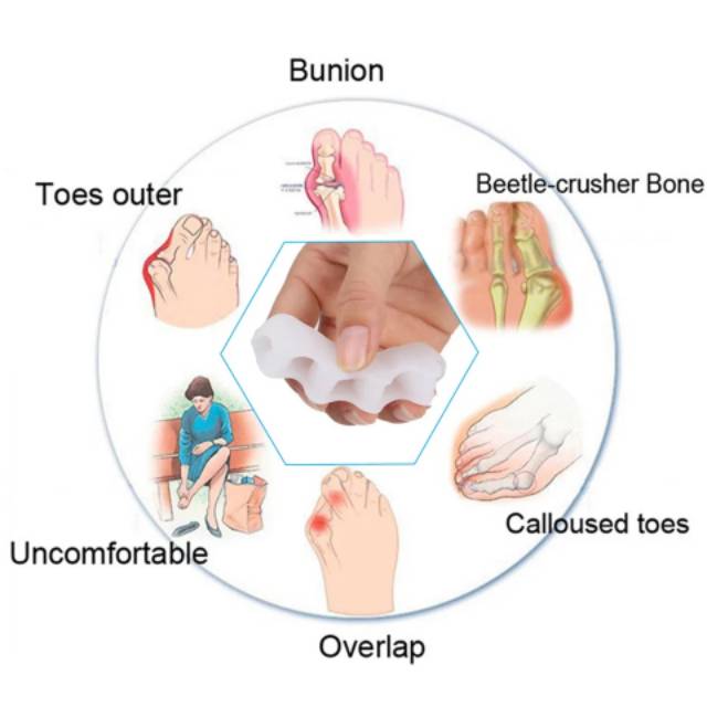 TOE SEPARATOR - SILIKON 5 JARI SILICONE HALLUX VALGUS