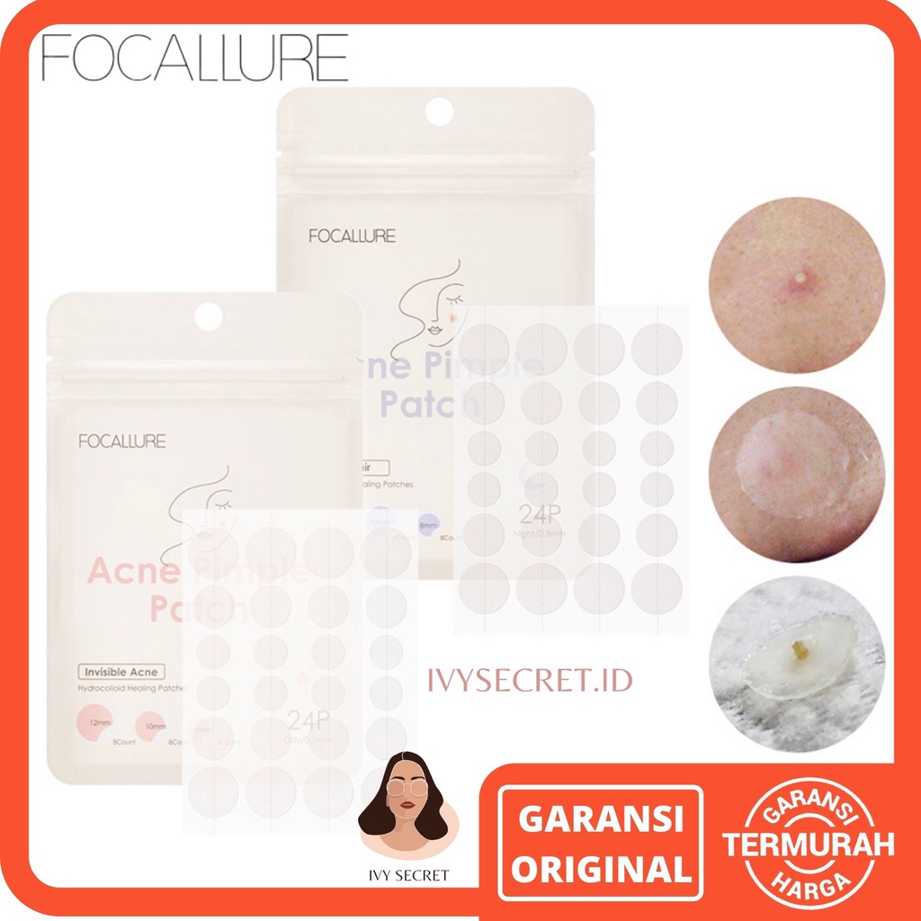 Focallure Pimple Patch Focallure Acne Patch Acne Pimple Patch Plaster Jerawat  Plester Jerawat Masker Jerawat Patch Jerawat Penutup Jerawat Stiker Jerawat Focallur Focalure Fucallure Focalure Foccalure