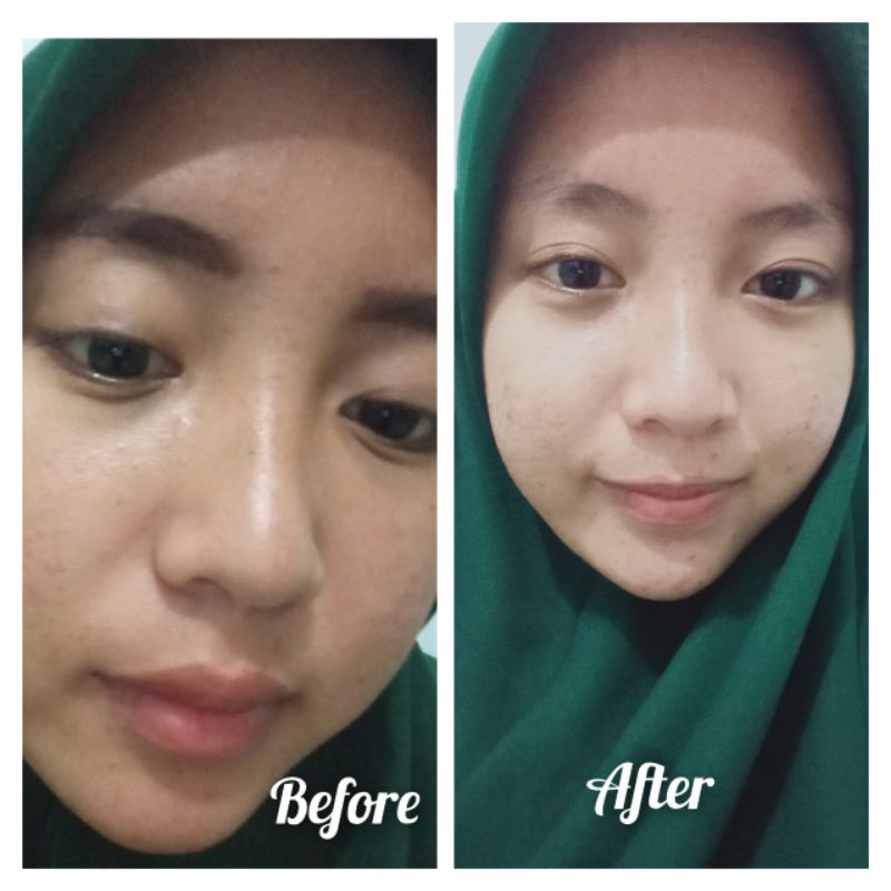 Nyrtea sabun pemutih badan dan wajah