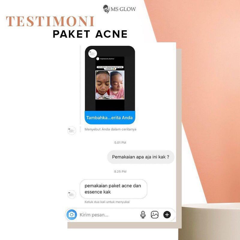 

MsglowAcne