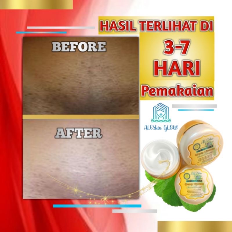 PAKET HEMAT PEMUTIH KETIAK CREAM MASKER dan Selangkangan Ampuh Bokong Pantat Siku Wajah Lutut Hitam