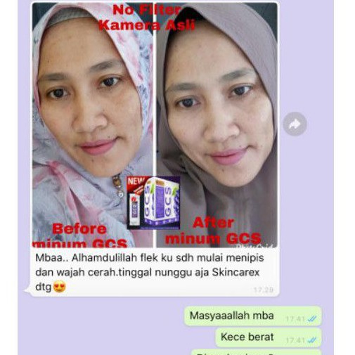 Minuman Pemutih Kulit alami - Atasi jerawat -MINUMAN GLUTATHIONE COLLAGEN GCS REVIVAR